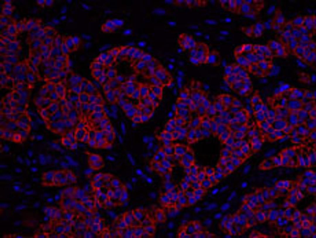 Detection of human ErbB2 by immunohistochemistry.