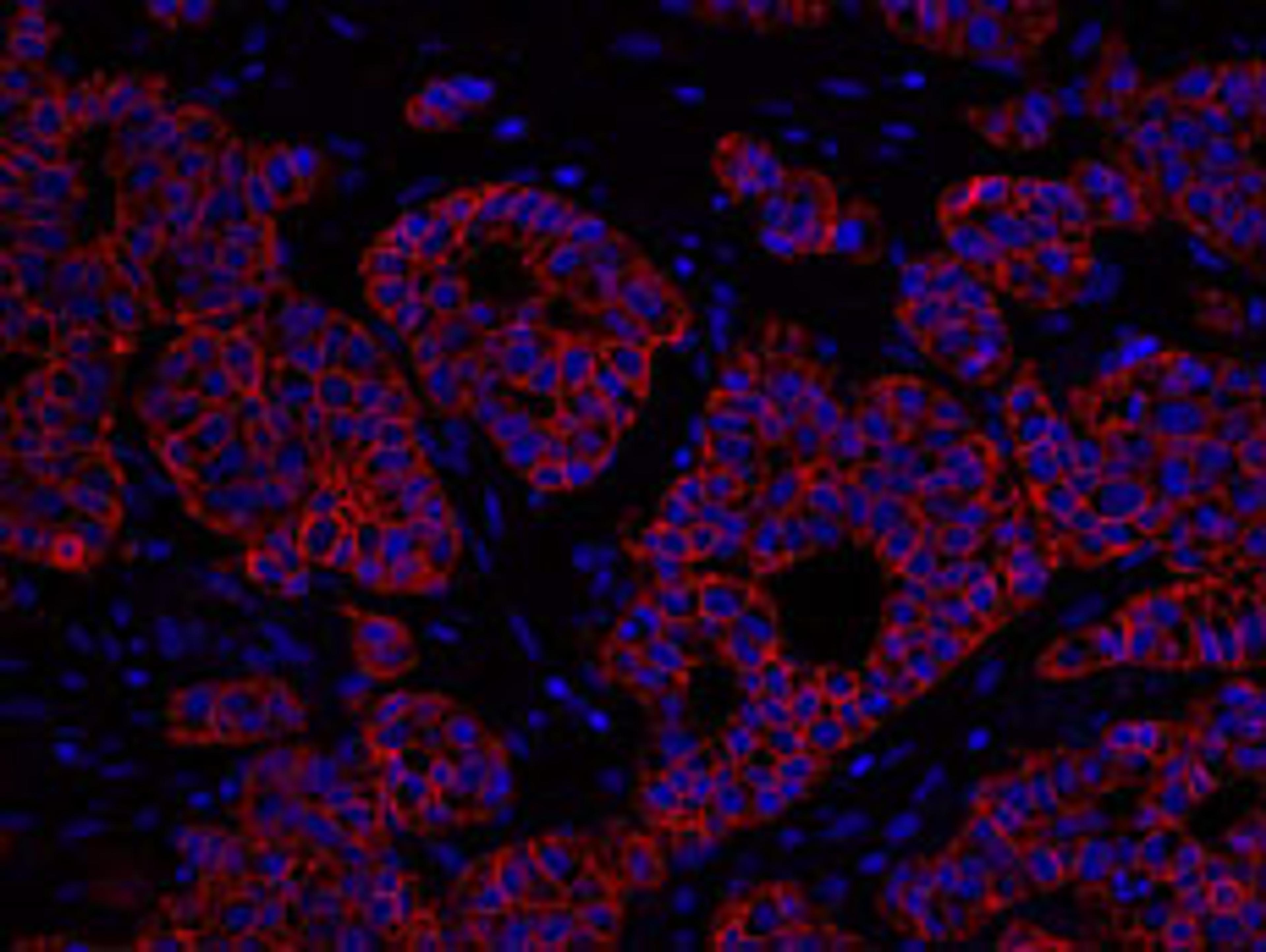 Detection of human ErbB2 by immunohistochemistry.