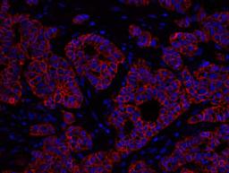 Detection of human ErbB2 by immunohistochemistry.