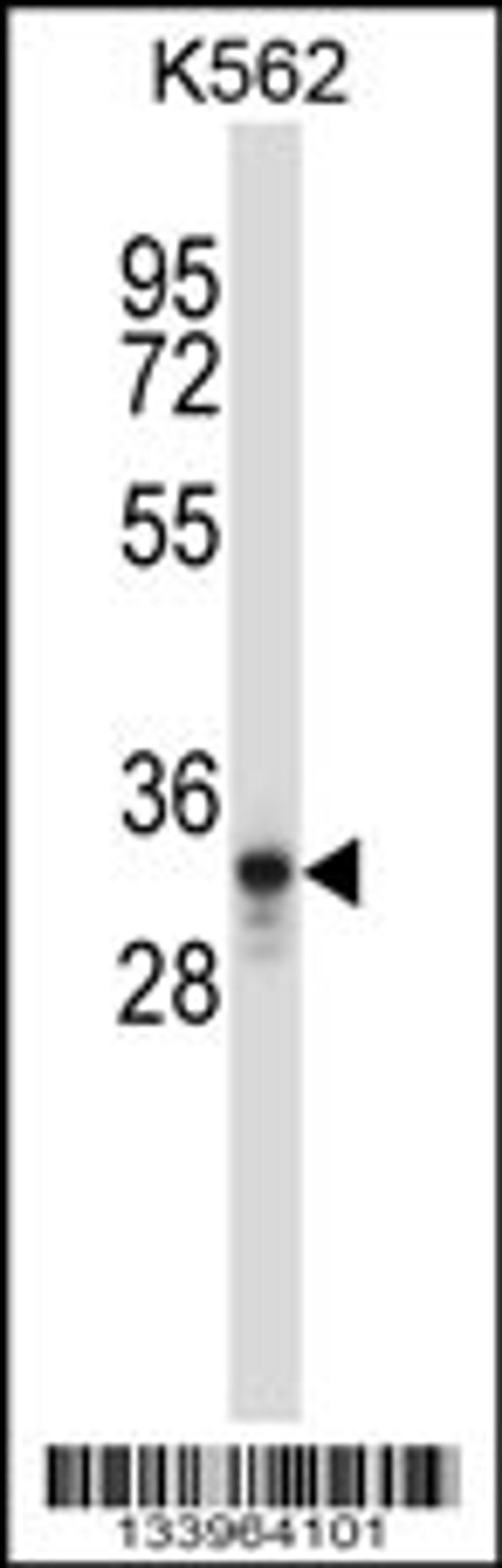 Western blot analysis in K562 cell line lysates (35ug/lane).