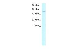 Antibody used in WB on Human HepG2 at 2.5 ug/ml.