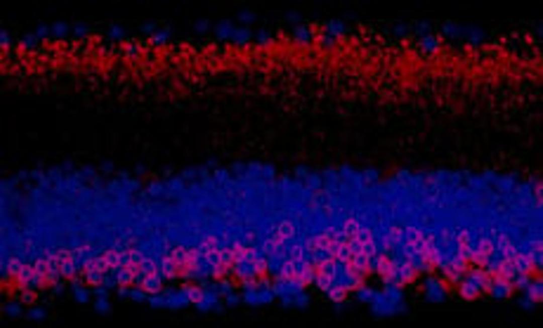 Detection of mouse PKC-alpha by immunohistochemistry.