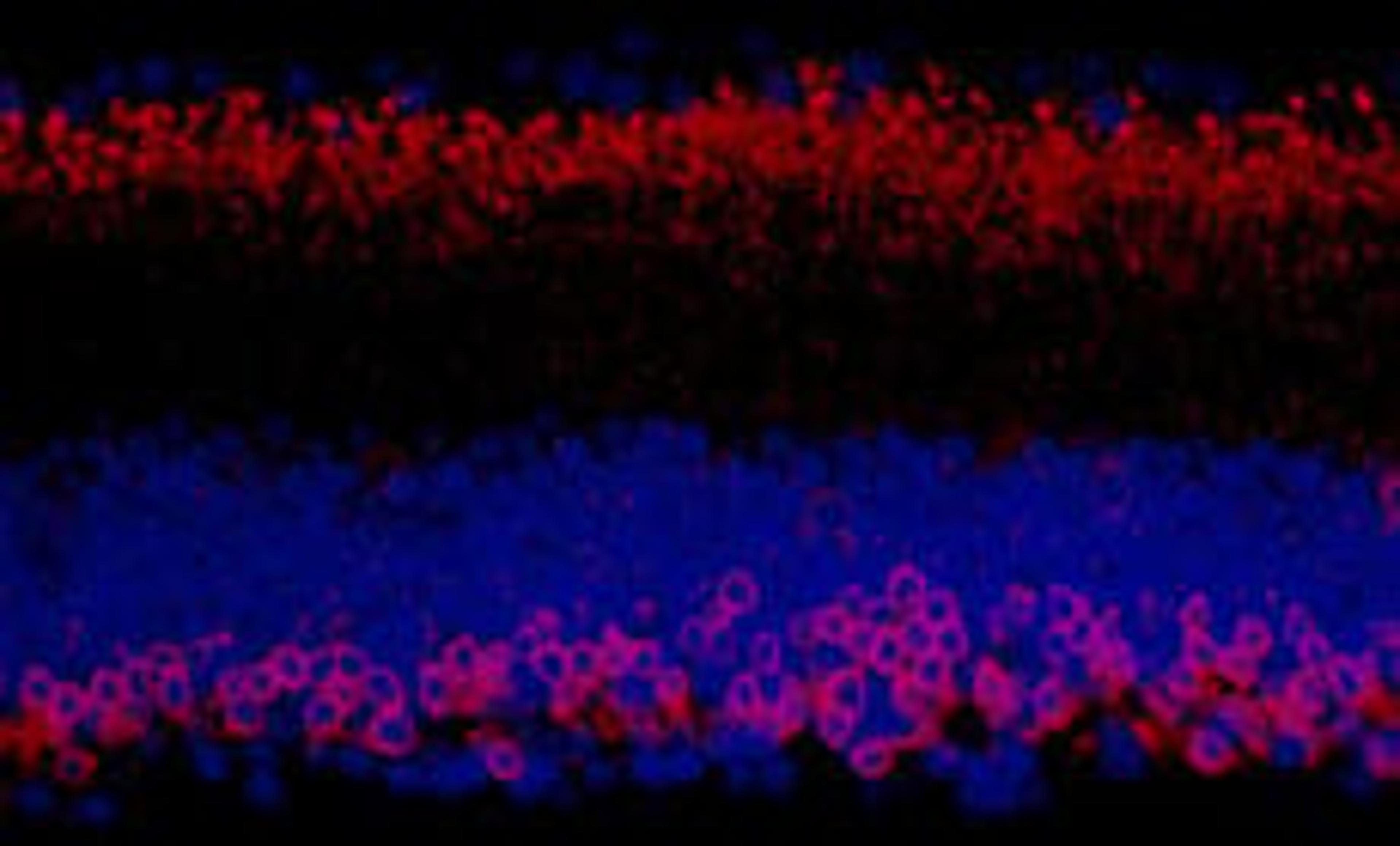 Detection of mouse PKC-alpha by immunohistochemistry.