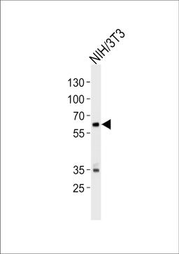 Western blot analysis of lysate from mouse NIH/3T3 cell line, using Mouse Ntrk2 Antibody at 1:1000 at each lane.