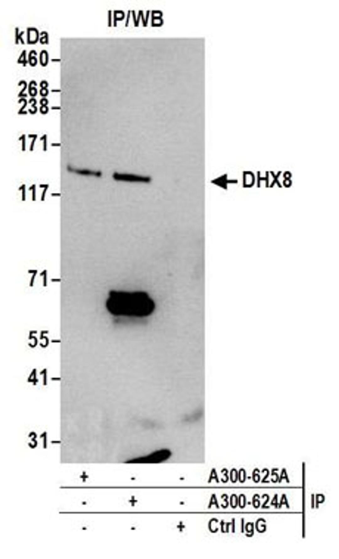 Detection of human DHX8 by western blot of immunoprecipitates.