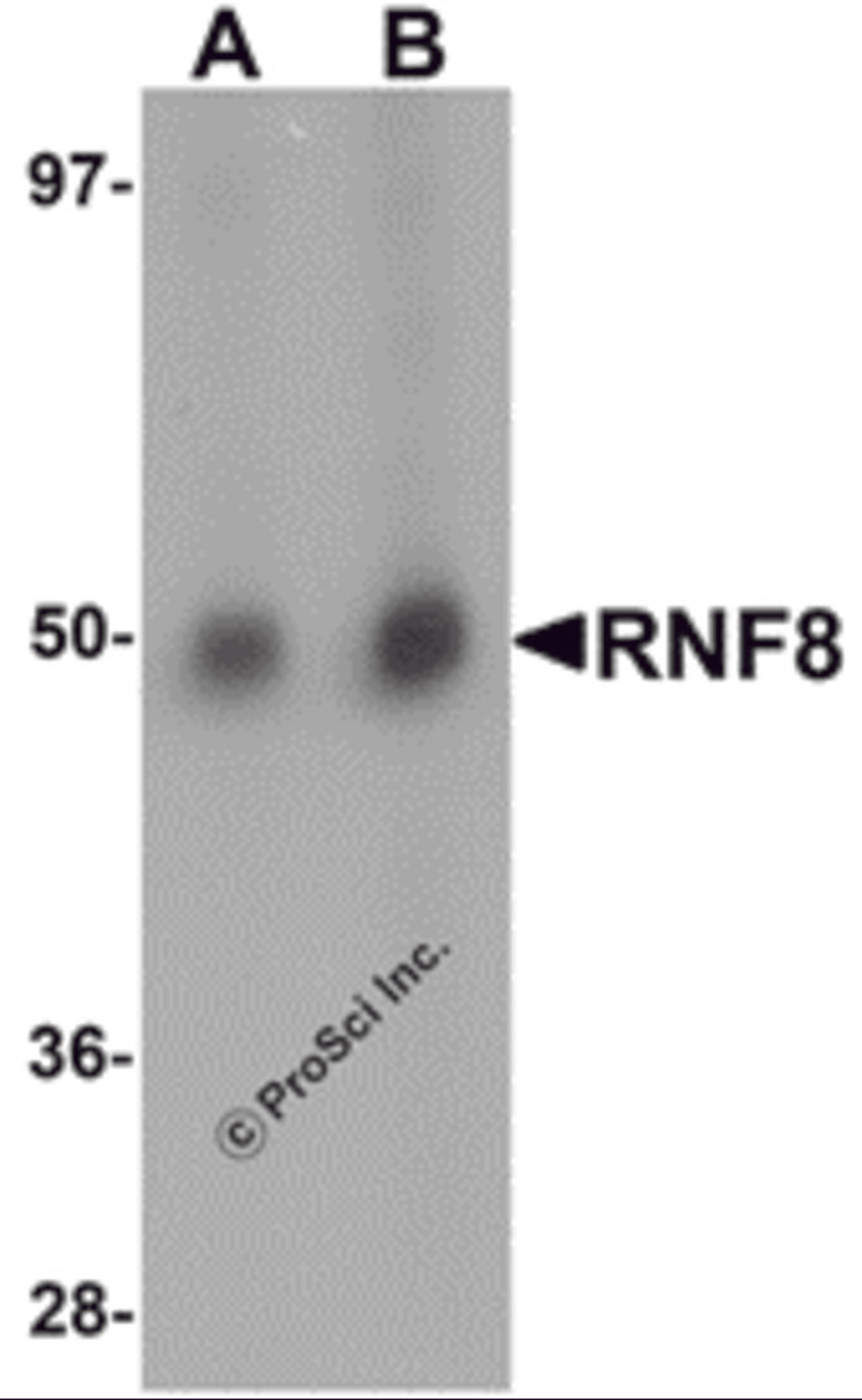 Western blot analysis of RNF8 in human lung tissue lysate with RNF8 antibody at (A) 1 and (B) 2 &#956;g/mL.