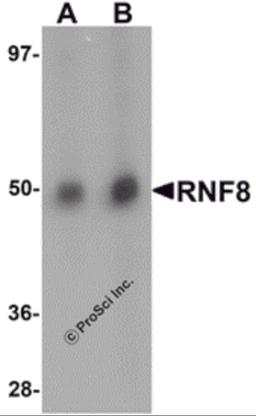 Western blot analysis of RNF8 in human lung tissue lysate with RNF8 antibody at (A) 1 and (B) 2 μg/mL.