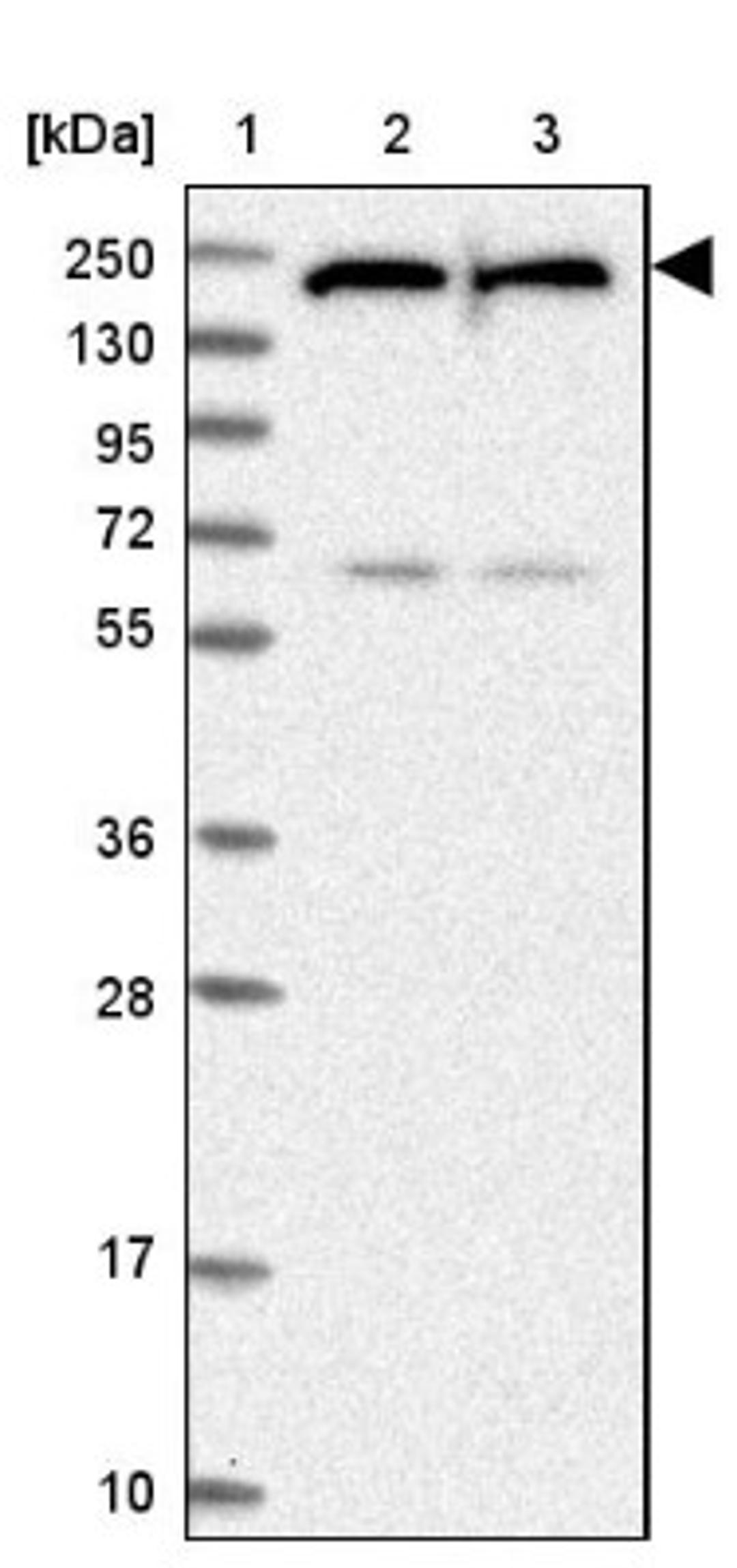 Western Blot: UACA Antibody [NBP1-92554] - Lane 1: Marker [kDa] 250, 130, 95, 72, 55, 36, 28, 17, 10<br/>Lane 2: Human cell line RT-4<br/>Lane 3: Human cell line U-251MG sp