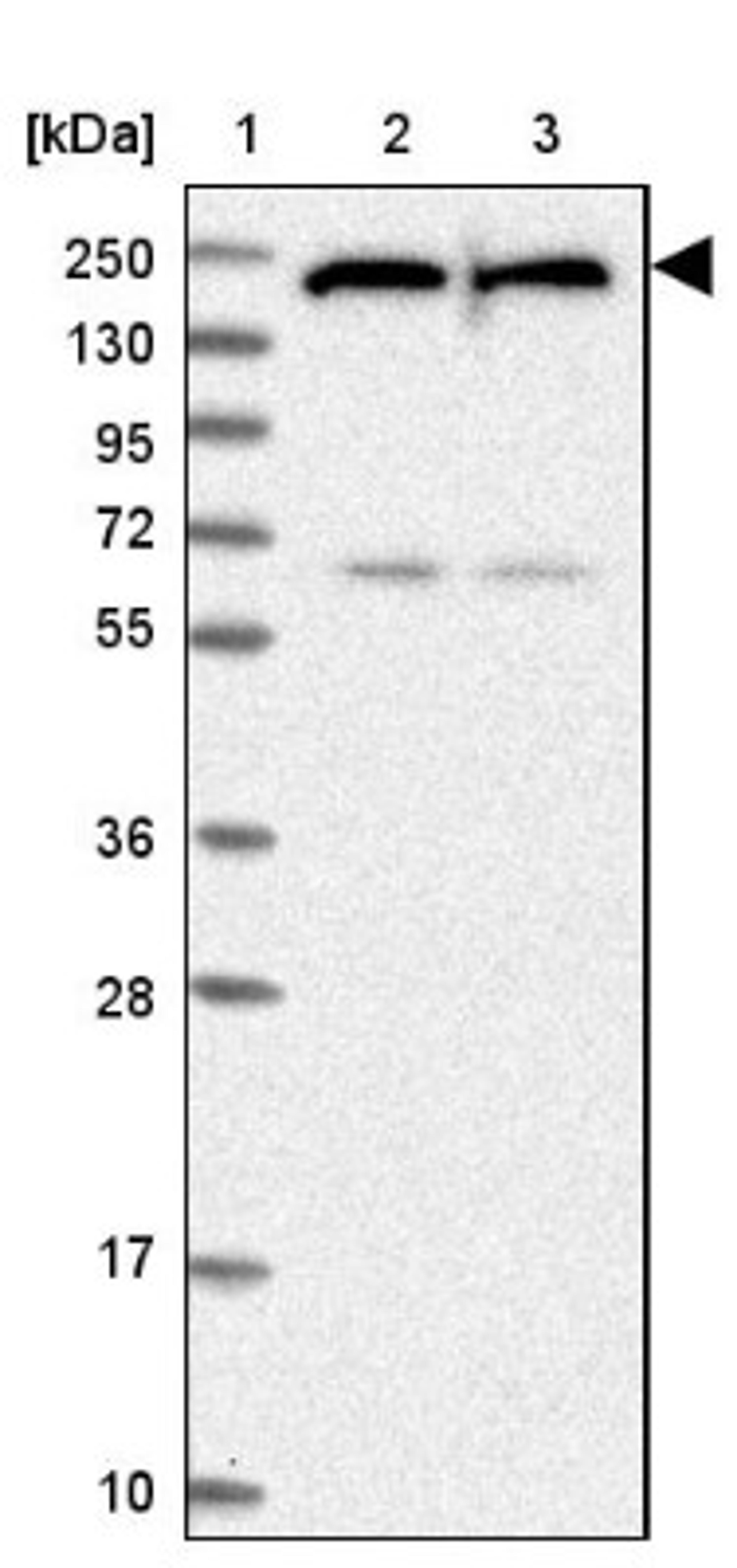 Western Blot: UACA Antibody [NBP1-92554] - Lane 1: Marker [kDa] 250, 130, 95, 72, 55, 36, 28, 17, 10<br/>Lane 2: Human cell line RT-4<br/>Lane 3: Human cell line U-251MG sp