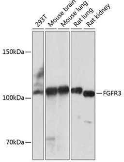 Western blot - FGFR3 antibody (A19052)