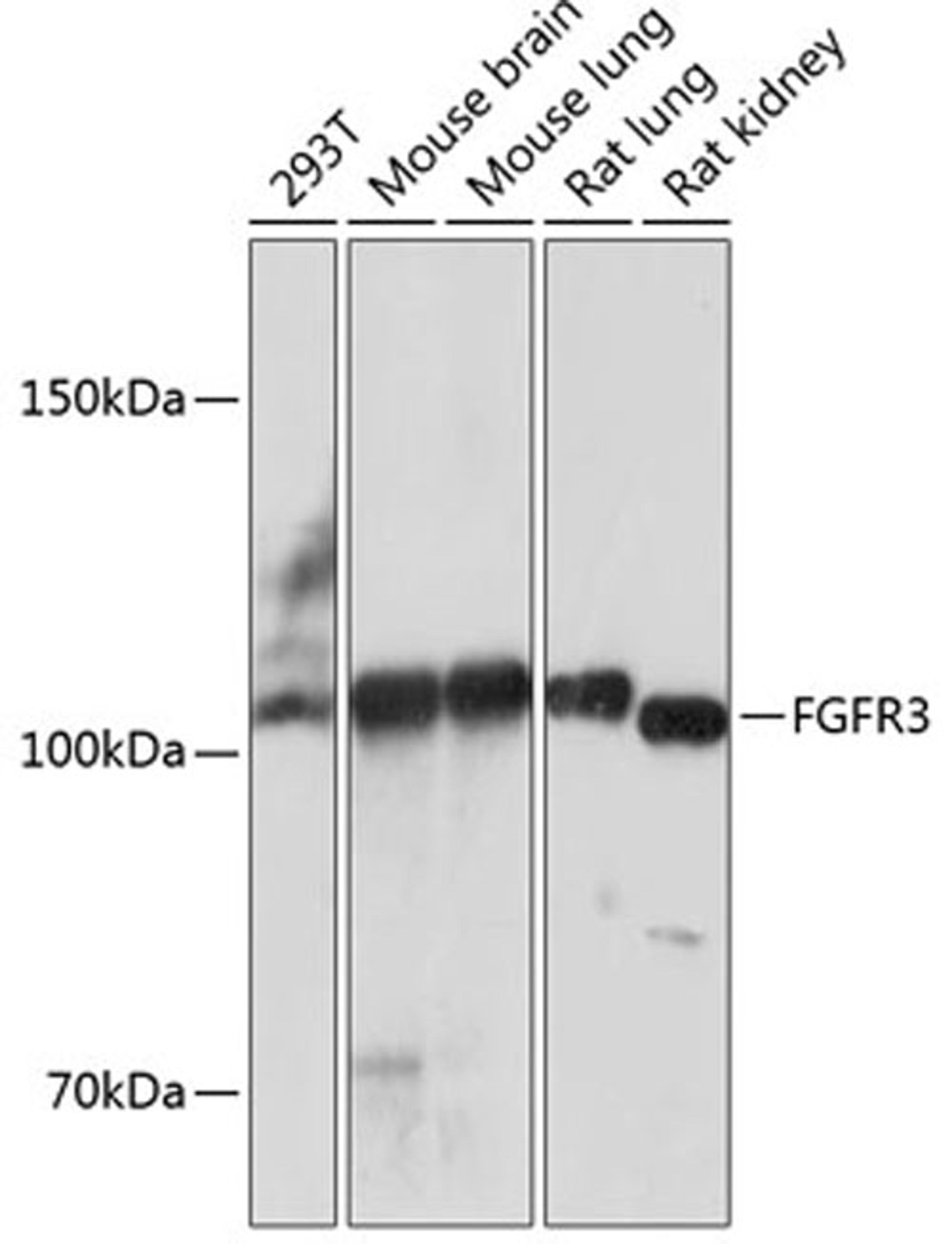 Western blot - FGFR3 antibody (A19052)