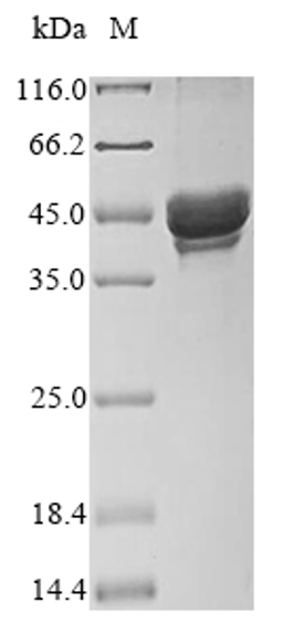 (Tris-Glycine gel) Discontinuous SDS-PAGE (reduced) with 5% enrichment gel and 15% separation gel.