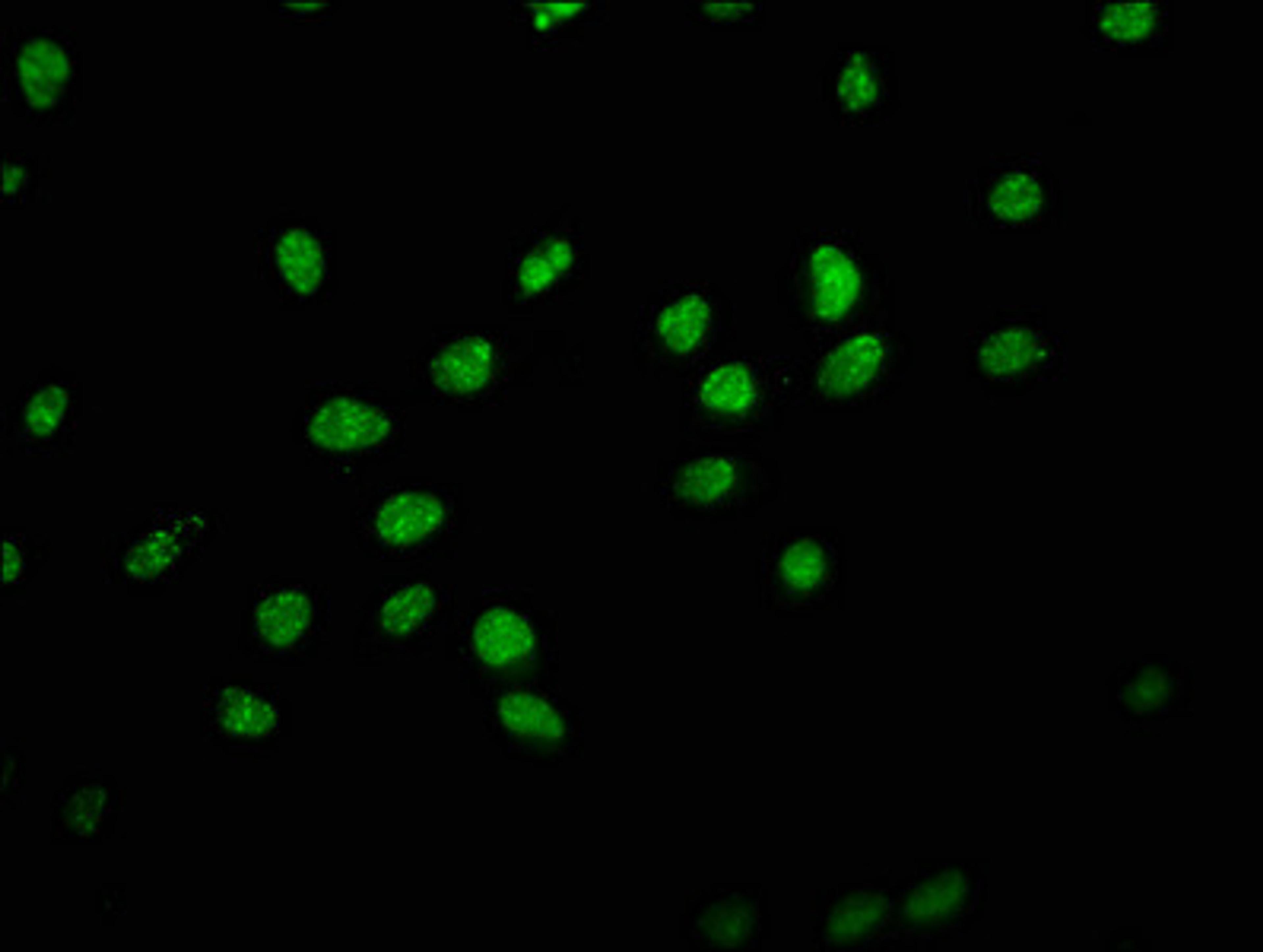 Immunofluorescence staining of Hela cells with CSB-PA010379OA179nphHU at 1:1, counter-stained with DAPI. The cells were fixed in 4% formaldehyde, permeabilized using 0.2% Triton X-100 and blocked in 10% normal Goat Serum. The cells were then incubated with the antibody overnight at 4&deg;C. The secondary antibody was Alexa Fluor 488-congugated AffiniPure Goat Anti-Rabbit IgG(H+L).