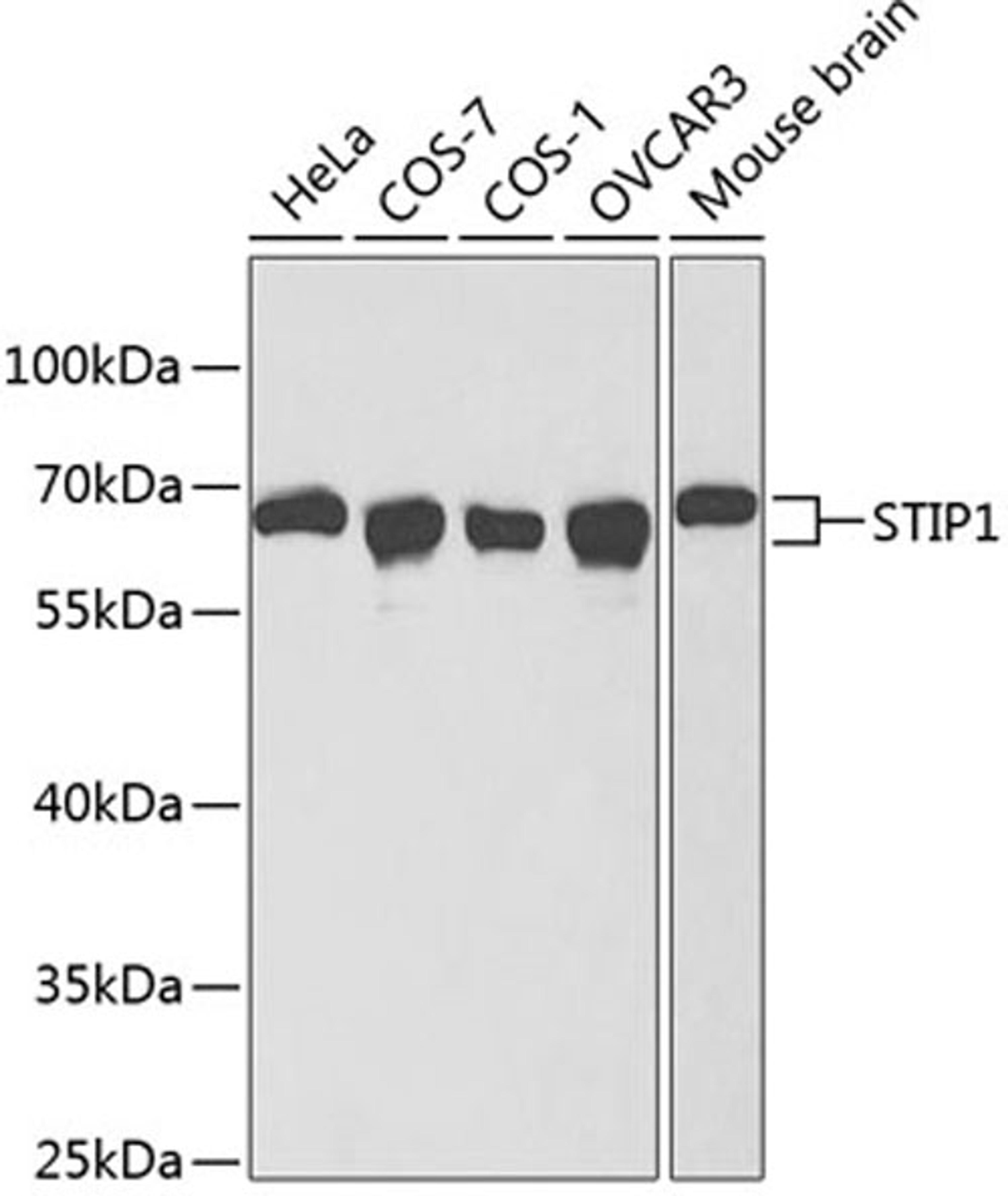 Western blot - STIP1 antibody (A1219)