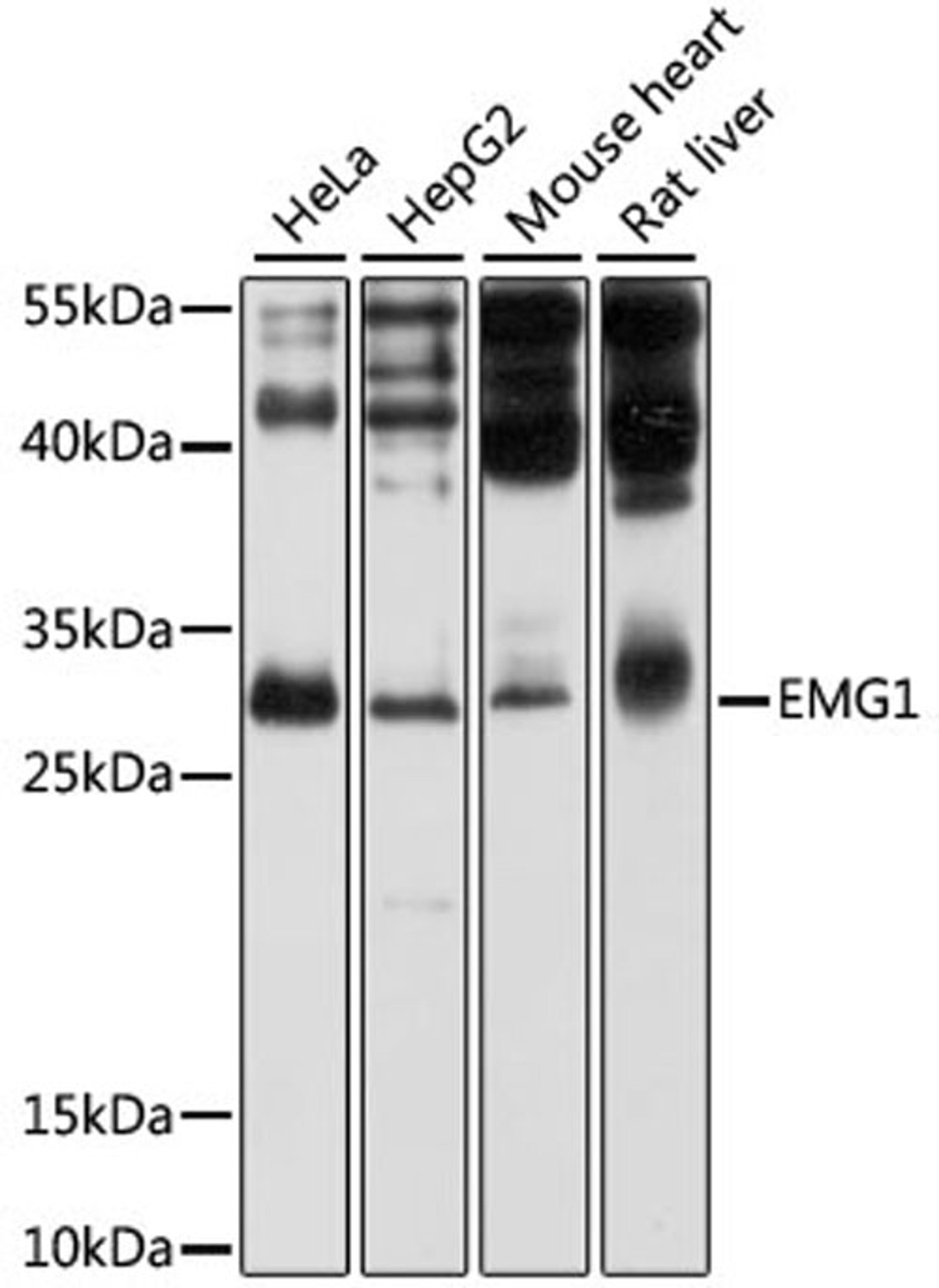 Western blot - EMG1 antibody (A4421)