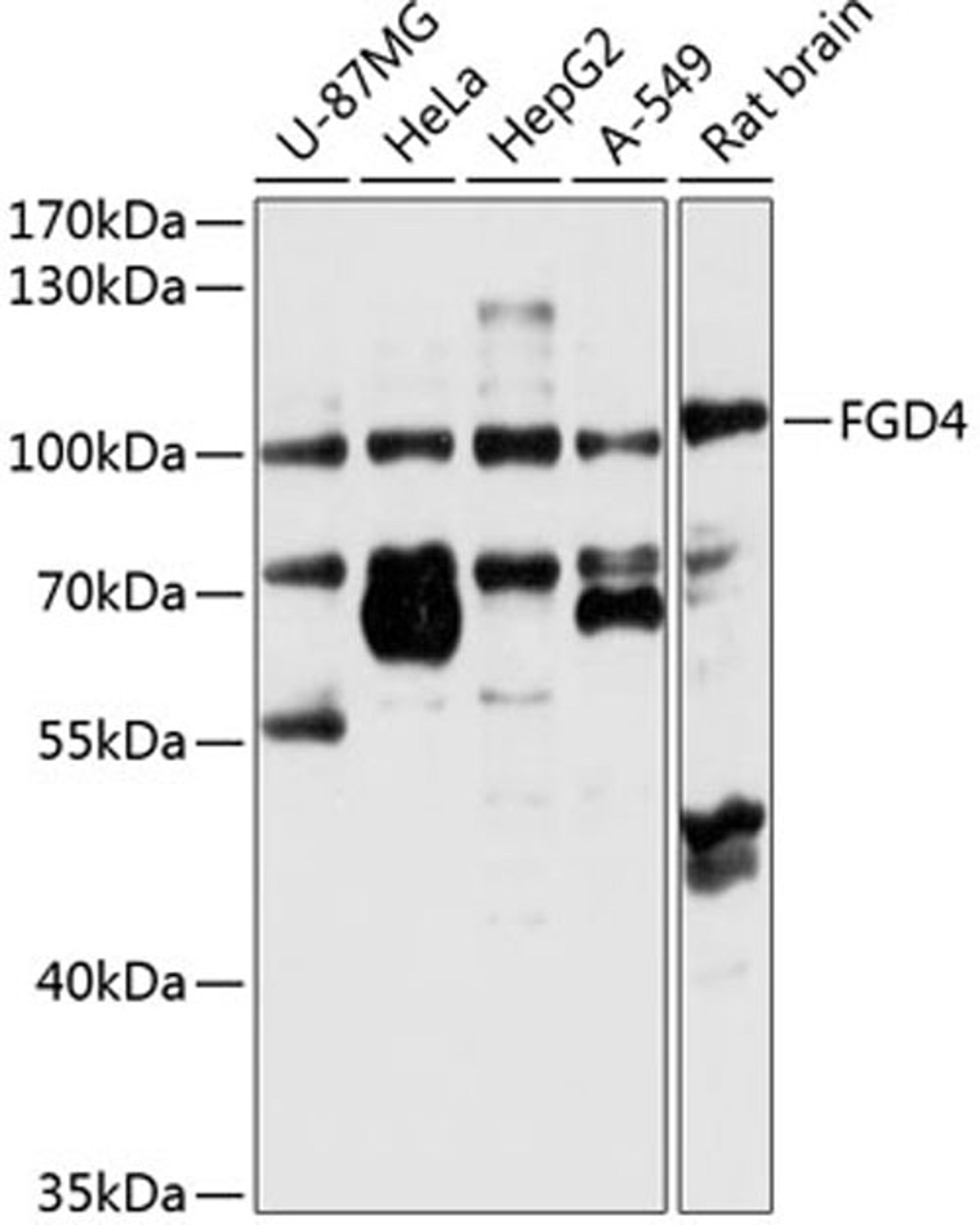 Western blot - FGD4 antibody (A8596)