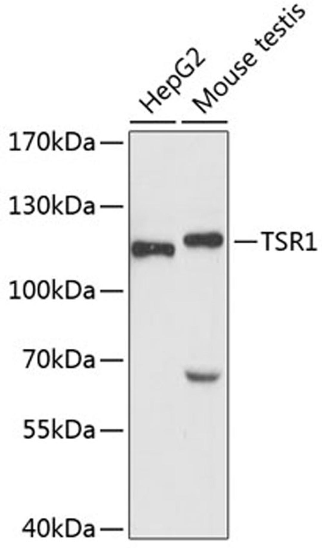 Western blot - TSR1 antibody (A4842)