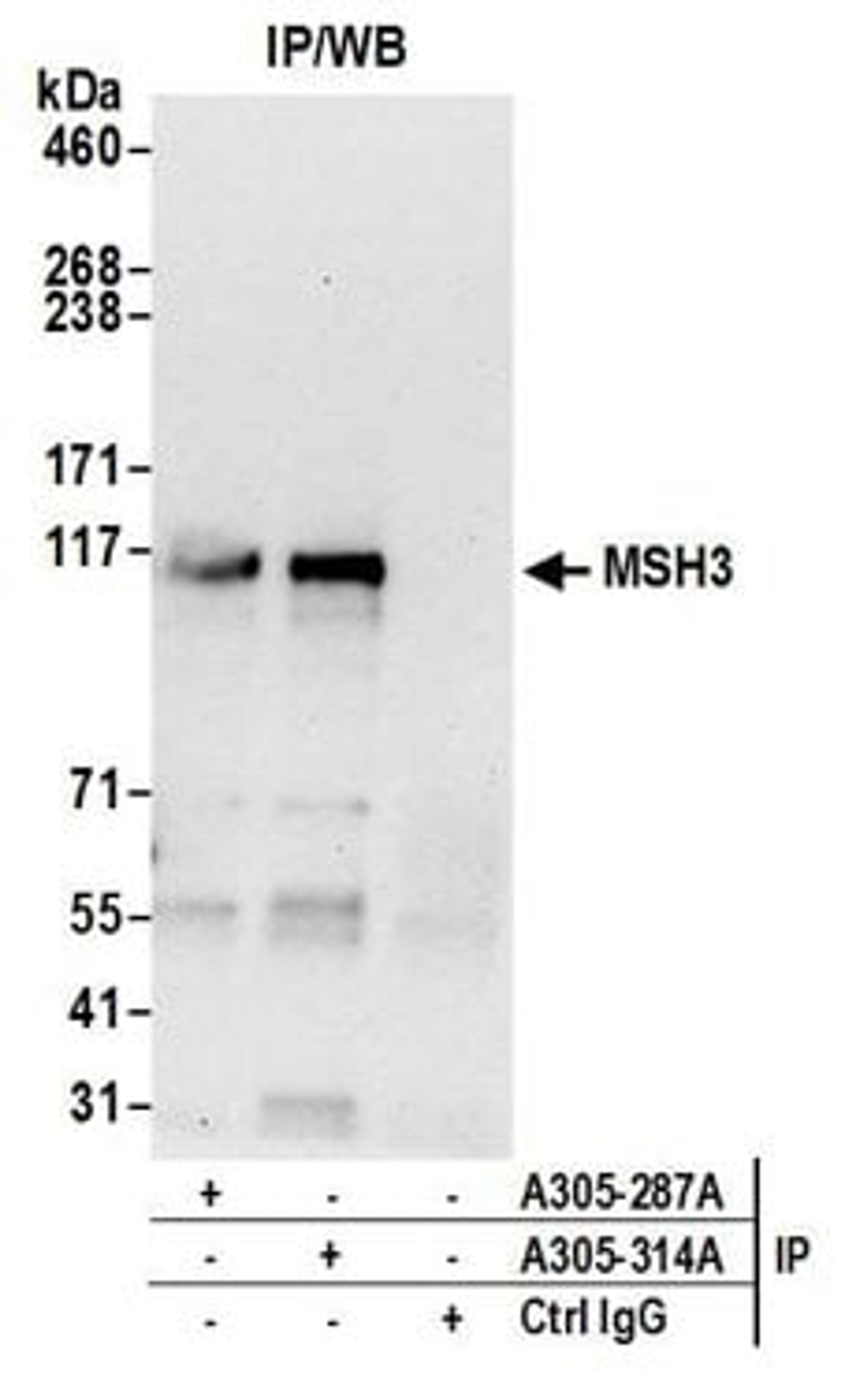 Detection of human MSH3 by western blot of immunoprecipitates.