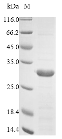 (Tris-Glycine gel) Discontinuous SDS-PAGE (reduced) with 5% enrichment gel and 15% separation gel.