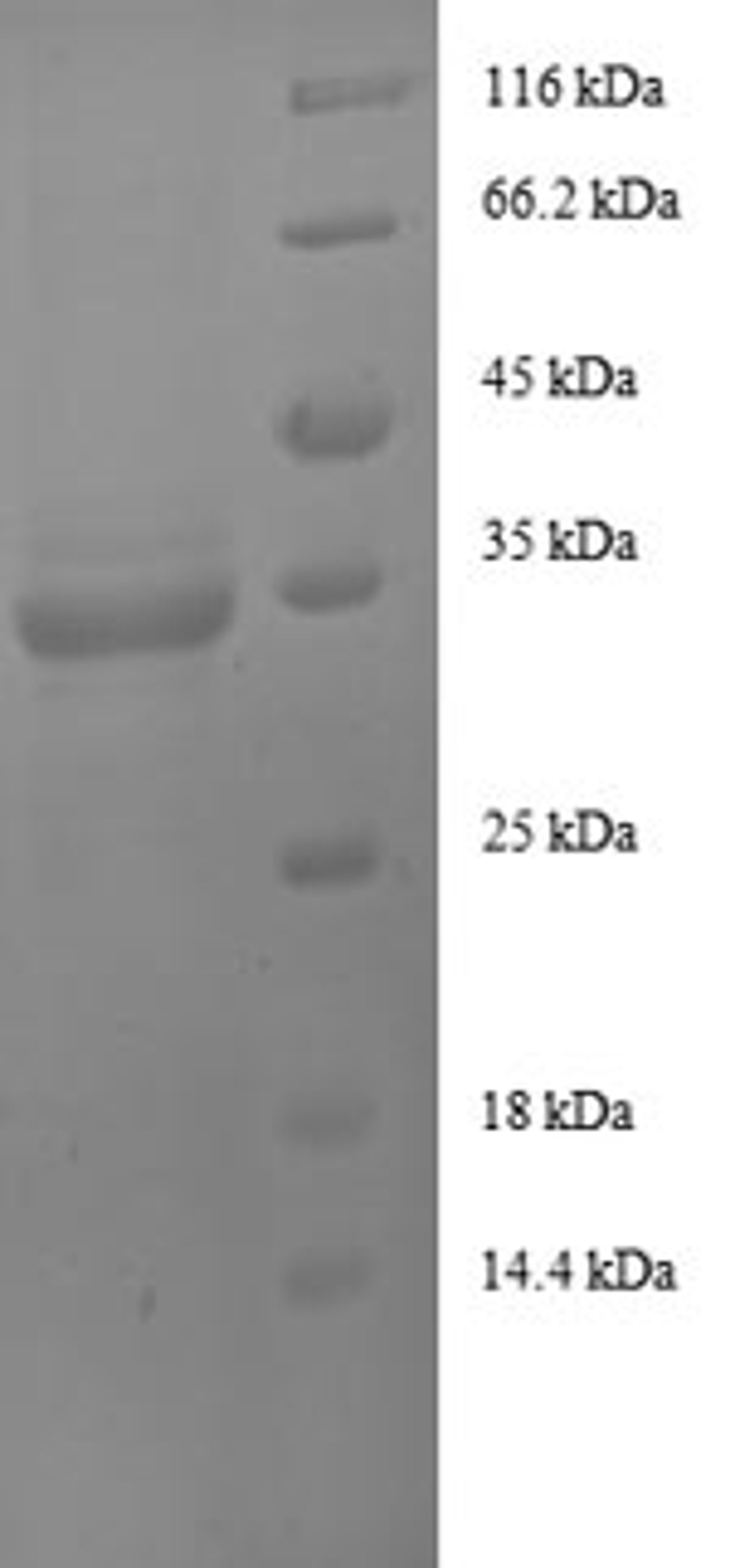(Tris-Glycine gel) Discontinuous SDS-PAGE (reduced) with 5% enrichment gel and 15% separation gel.