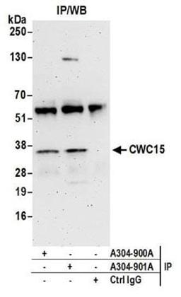 Detection of human CWC15 by western blot of immunoprecipitates.