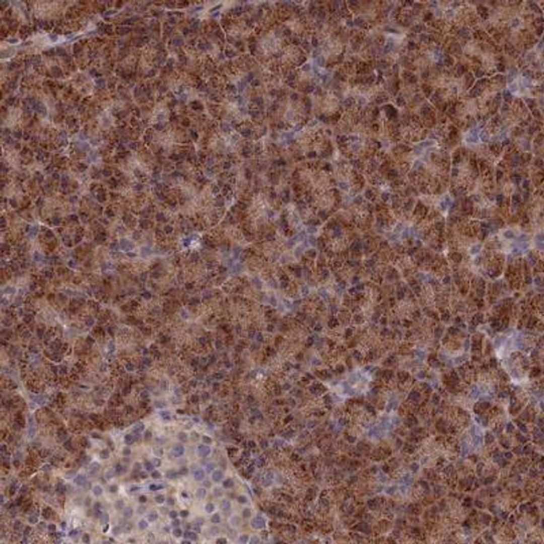 Immunohistochemistry-Paraffin: Biliverdin Reductase A/BLVRA Antibody [NBP1-90757] - Immunohistochemical staining of human pancreas shows strong cytoplasmic positivity in exocrine glandular cells.