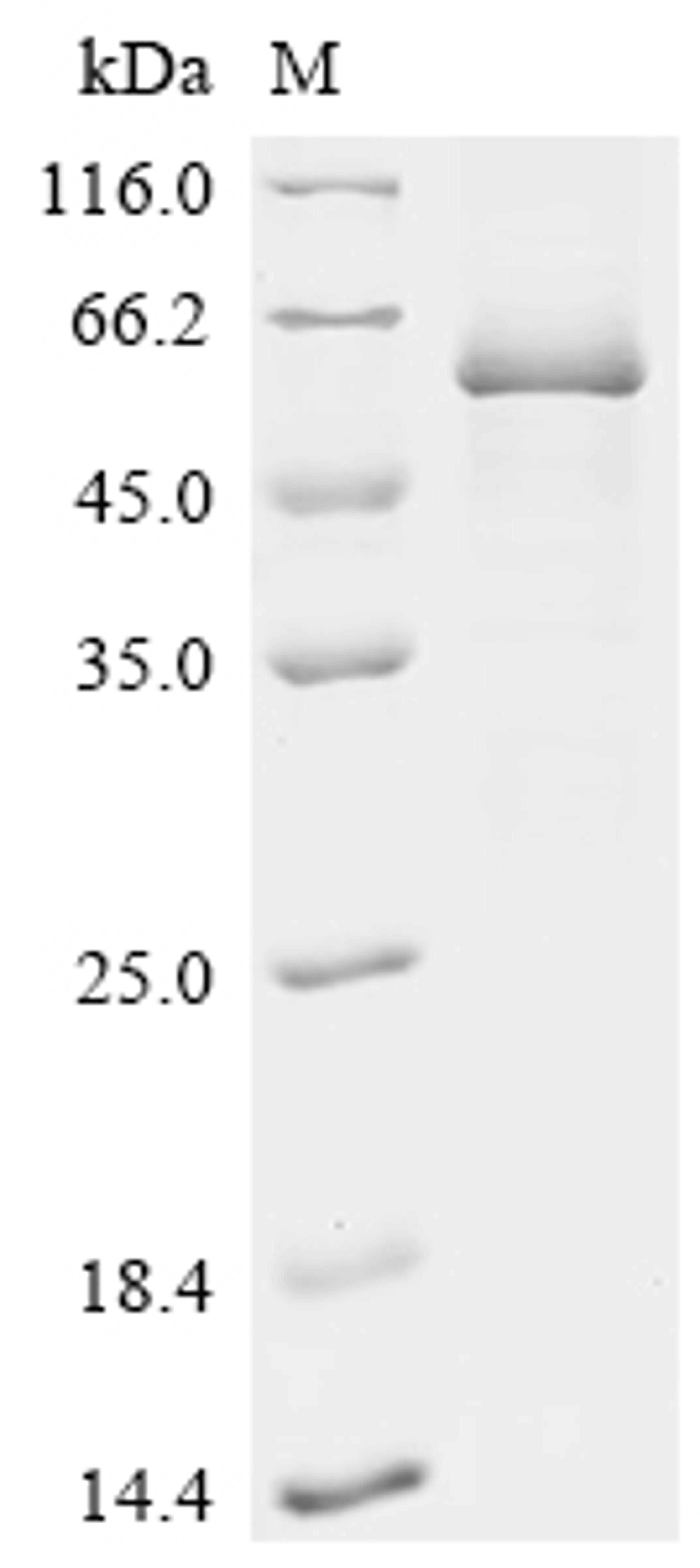 (Tris-Glycine gel) Discontinuous SDS-PAGE (reduced) with 5% enrichment gel and 15% separation gel.