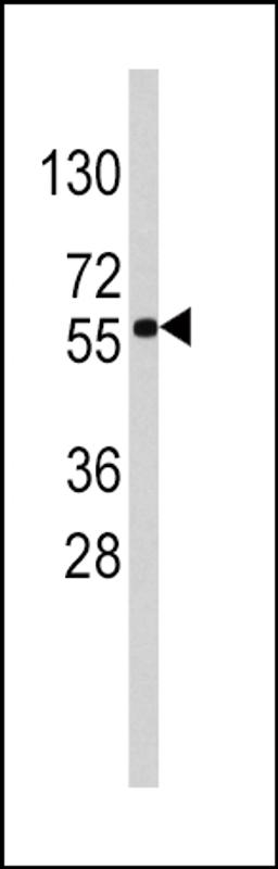 Western blot analysis of anti-SOX9 Antibody in HepG2 cell line lysates (35ug/lane)