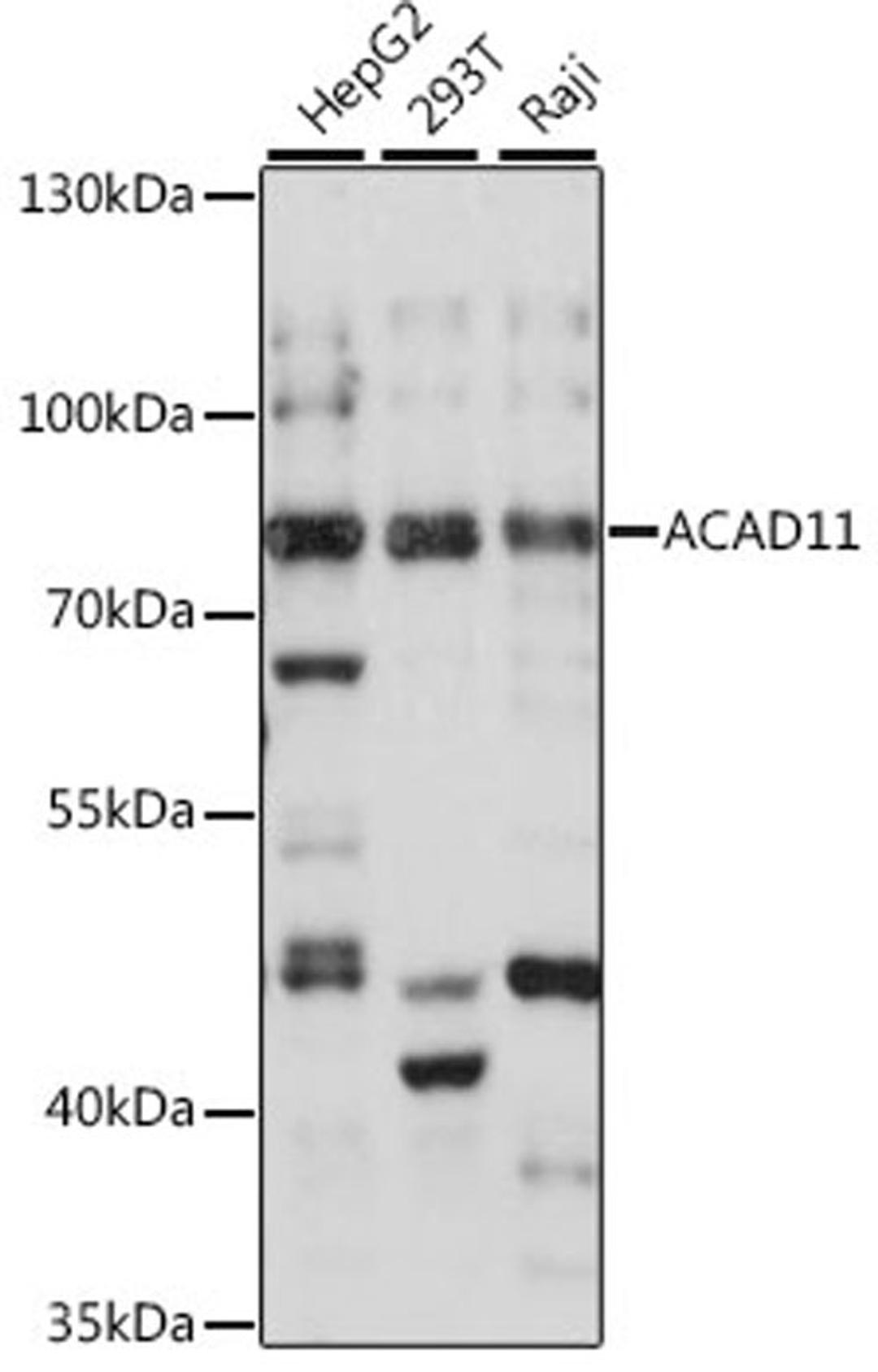 Western blot - ACAD11 antibody (A16153)