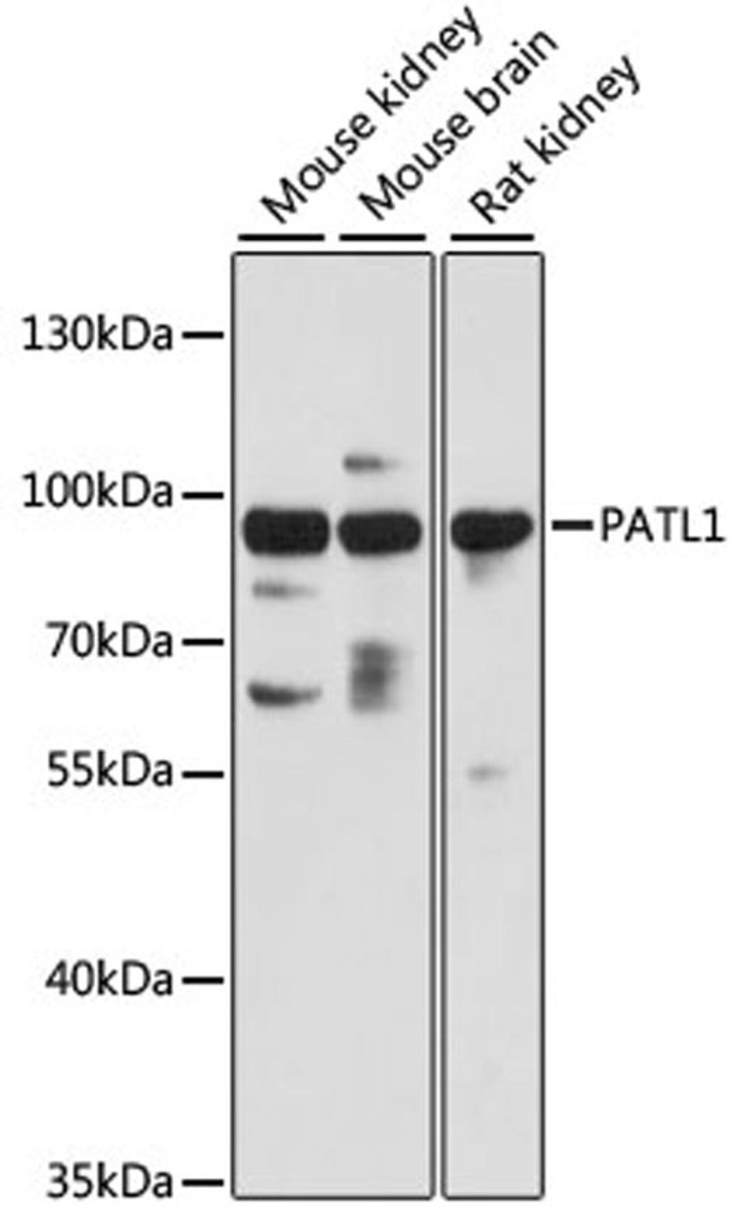 Western blot - PATL1 antibody (A13170)