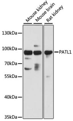 Western blot - PATL1 antibody (A13170)