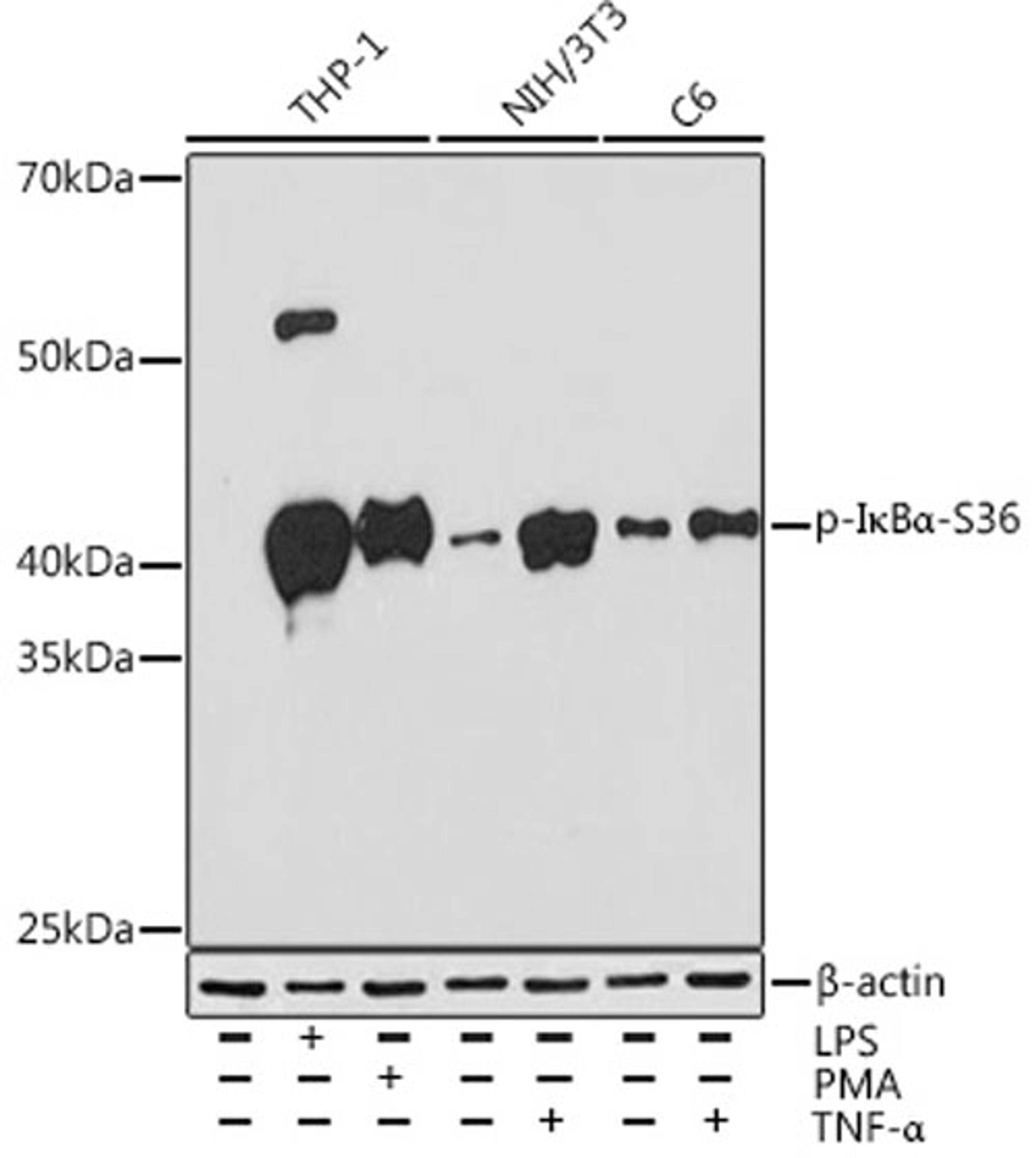 Western blot - Phospho-I?Ba-S36 Rabbit mAb (AP0999)