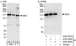 Detection of human INF2 by western blot and immunoprecipitation.