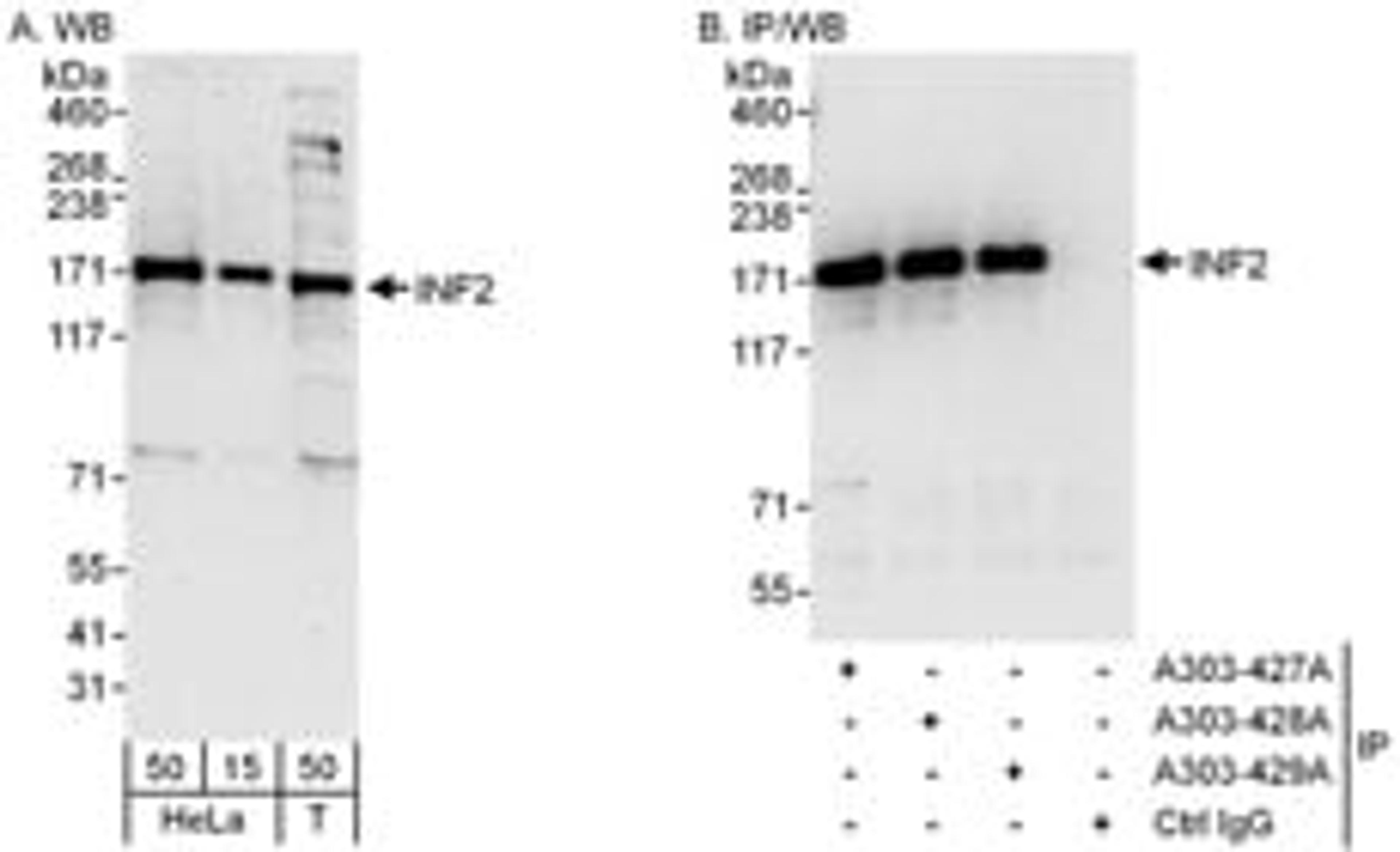 Detection of human INF2 by western blot and immunoprecipitation.