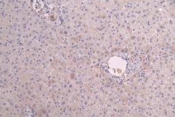IHC image of CSB-RA011591MA1HU diluted at 1:200 and staining in paraffin-embedded human liver tissue performed on a Leica BondTM system. After dewaxing and hydration, antigen retrieval was mediated by high pressure in a citrate buffer (pH 6.0). Section was blocked with 10% normal goat serum 30min at RT. Then primary antibody (1% BSA) was incubated at 4°C overnight. The primary is detected by a Goat anti-human polymer IgG labeled by HRP and visualized using 0.05% DAB.
