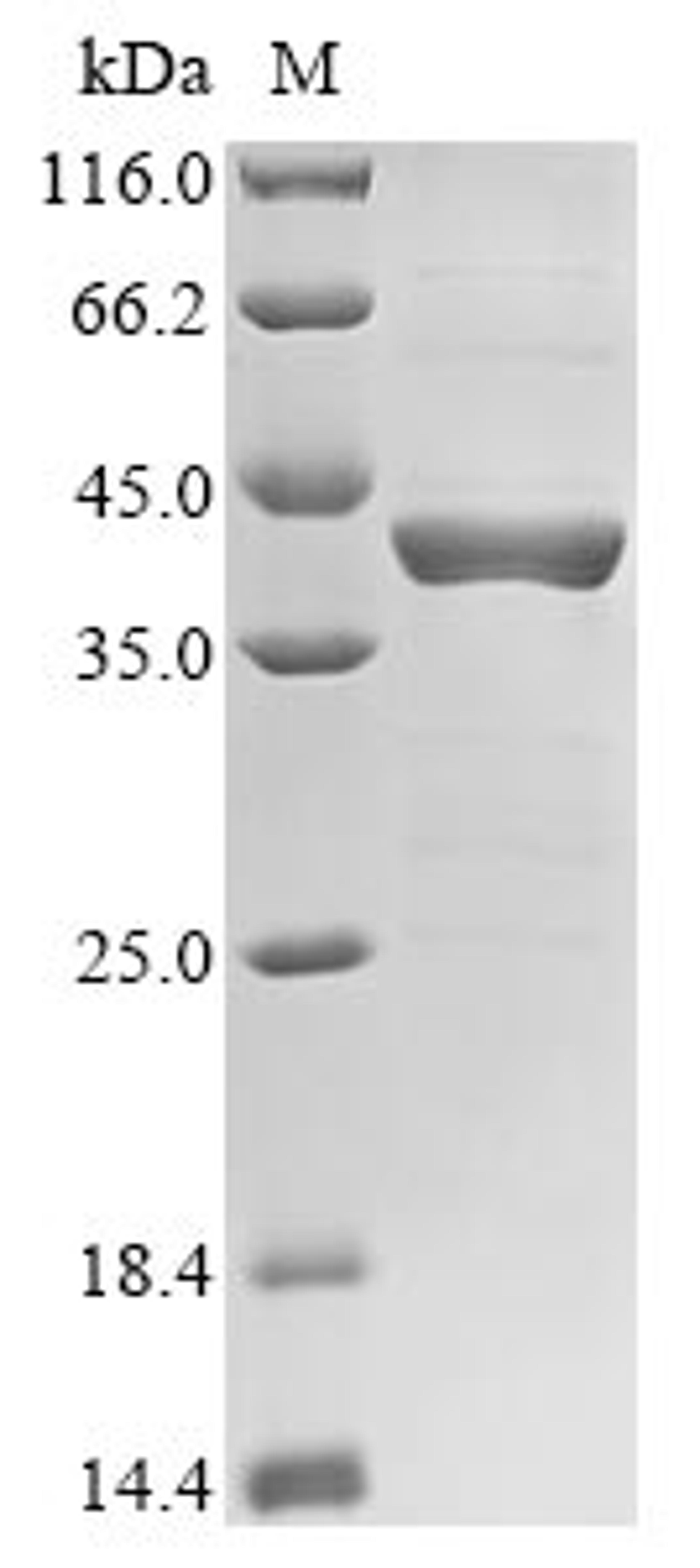 (Tris-Glycine gel) Discontinuous SDS-PAGE (reduced) with 5% enrichment gel and 15% separation gel.