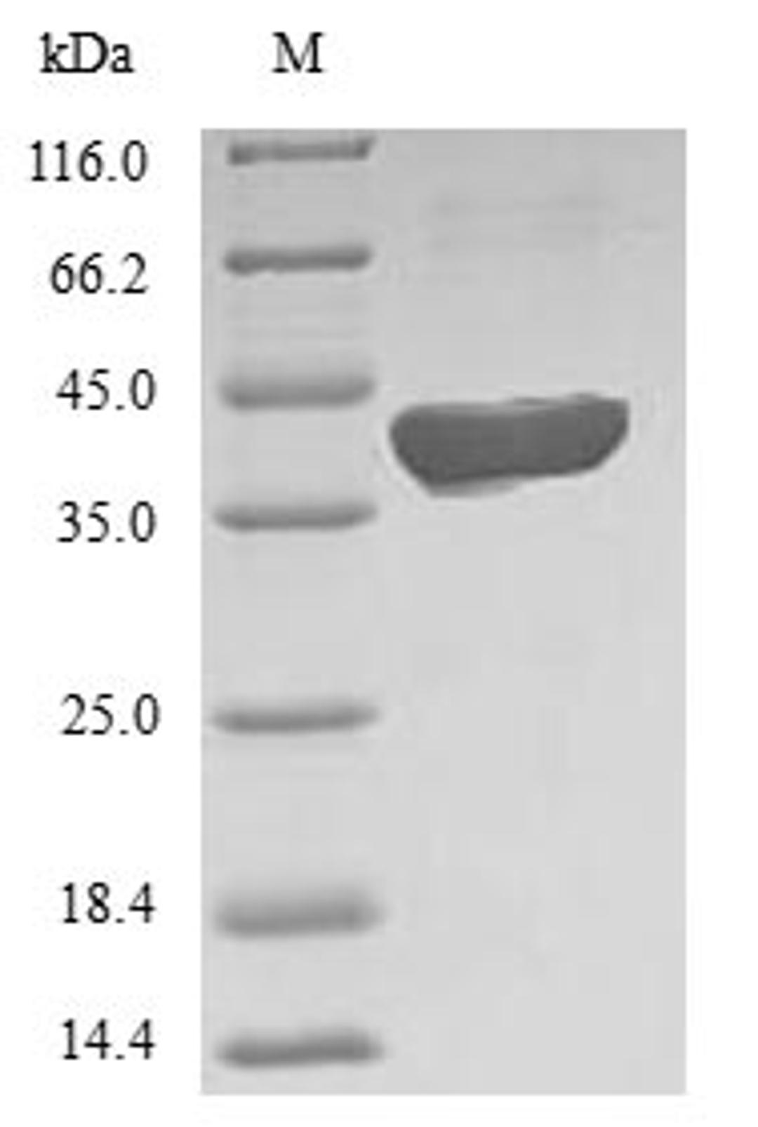 (Tris-Glycine gel) Discontinuous SDS-PAGE (reduced) with 5% enrichment gel and 15% separation gel.
