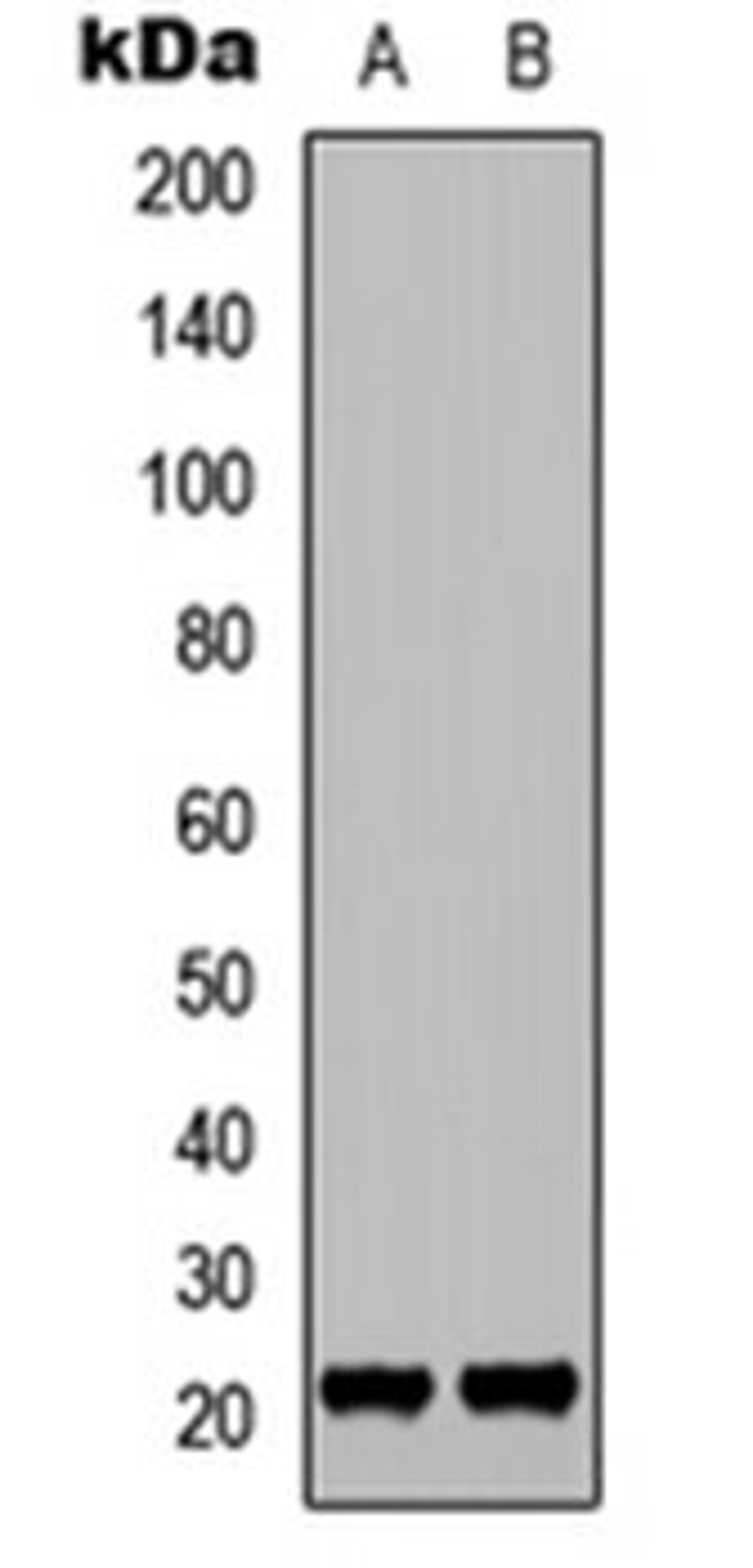 Western blot analysis of HT1080 EGF-treated (Lane 1), HeLa EGF-treated (Lane 2) whole cell lysates using p21 (phospho-T145) antibody