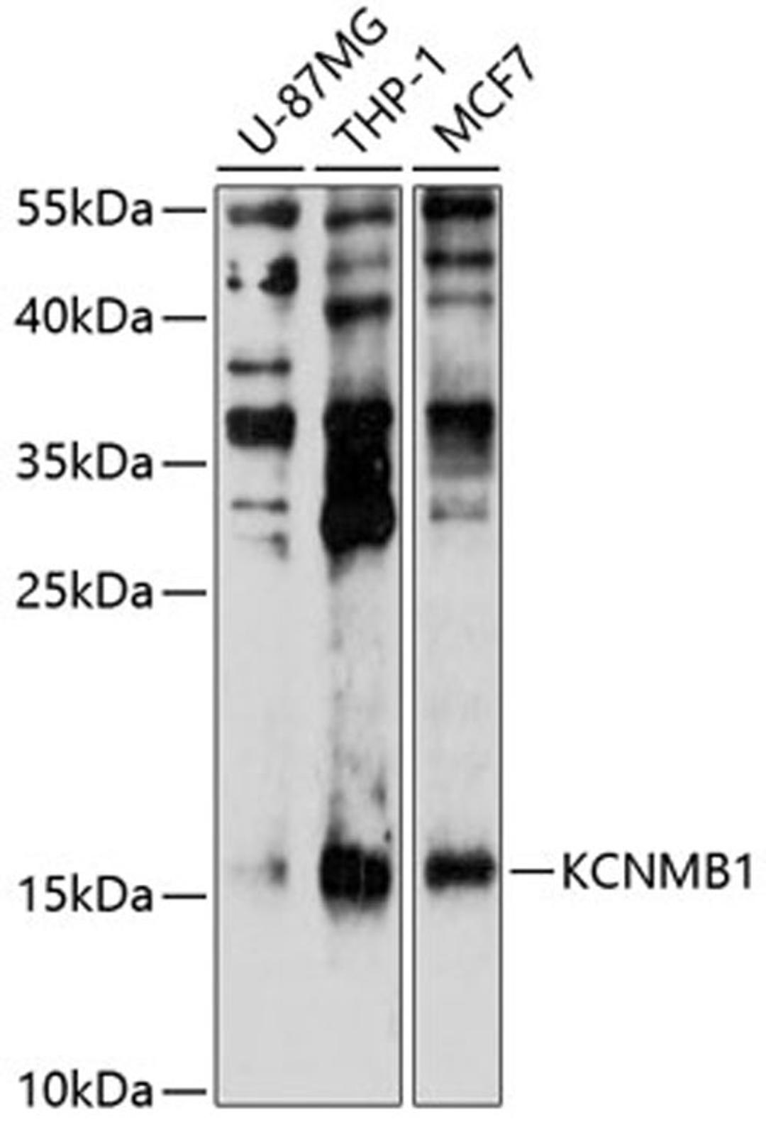 Western blot - KCNMB1 antibody (A10224)