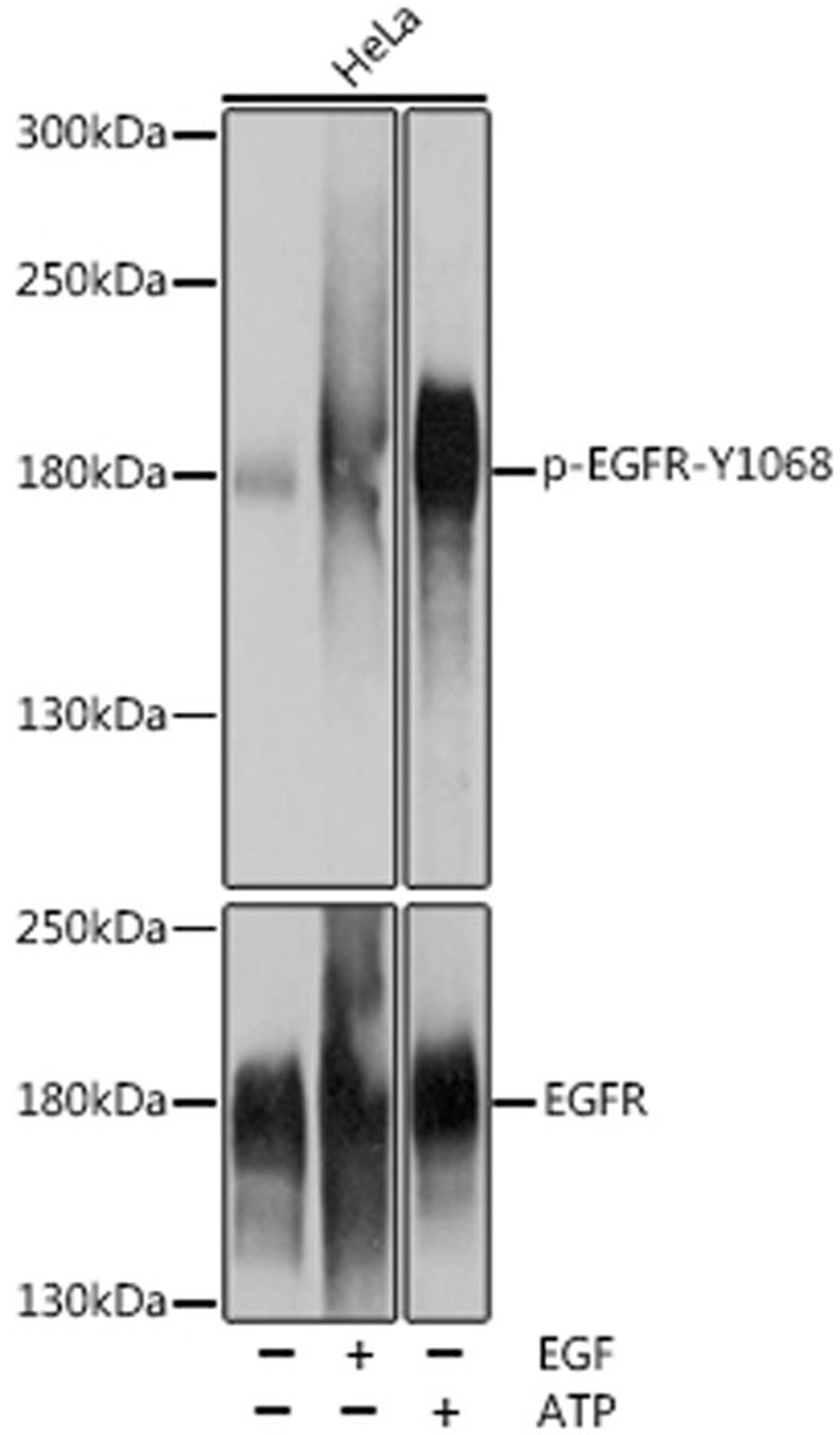 Western blot - Phospho-EGFR-Y1068 pAb (AP0301)