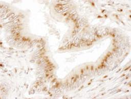 Detection of human TGOLN2 by immunohistochemistry.