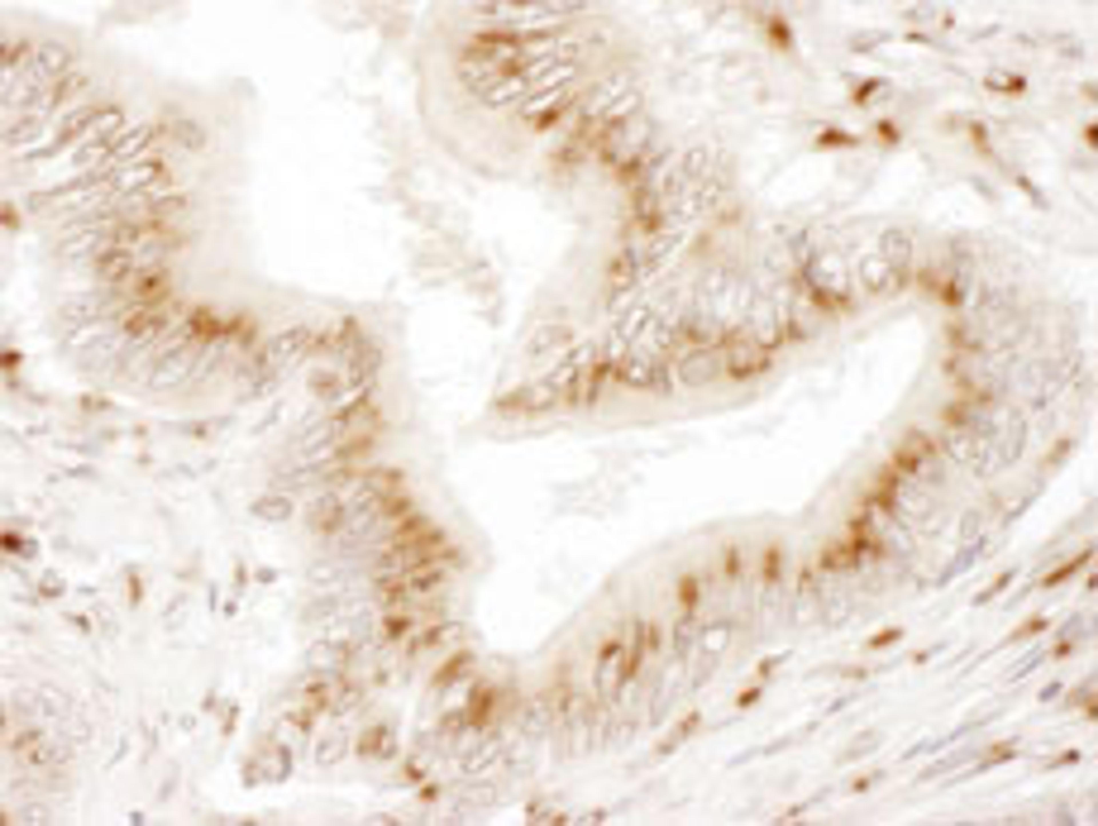 Detection of human TGOLN2 by immunohistochemistry.