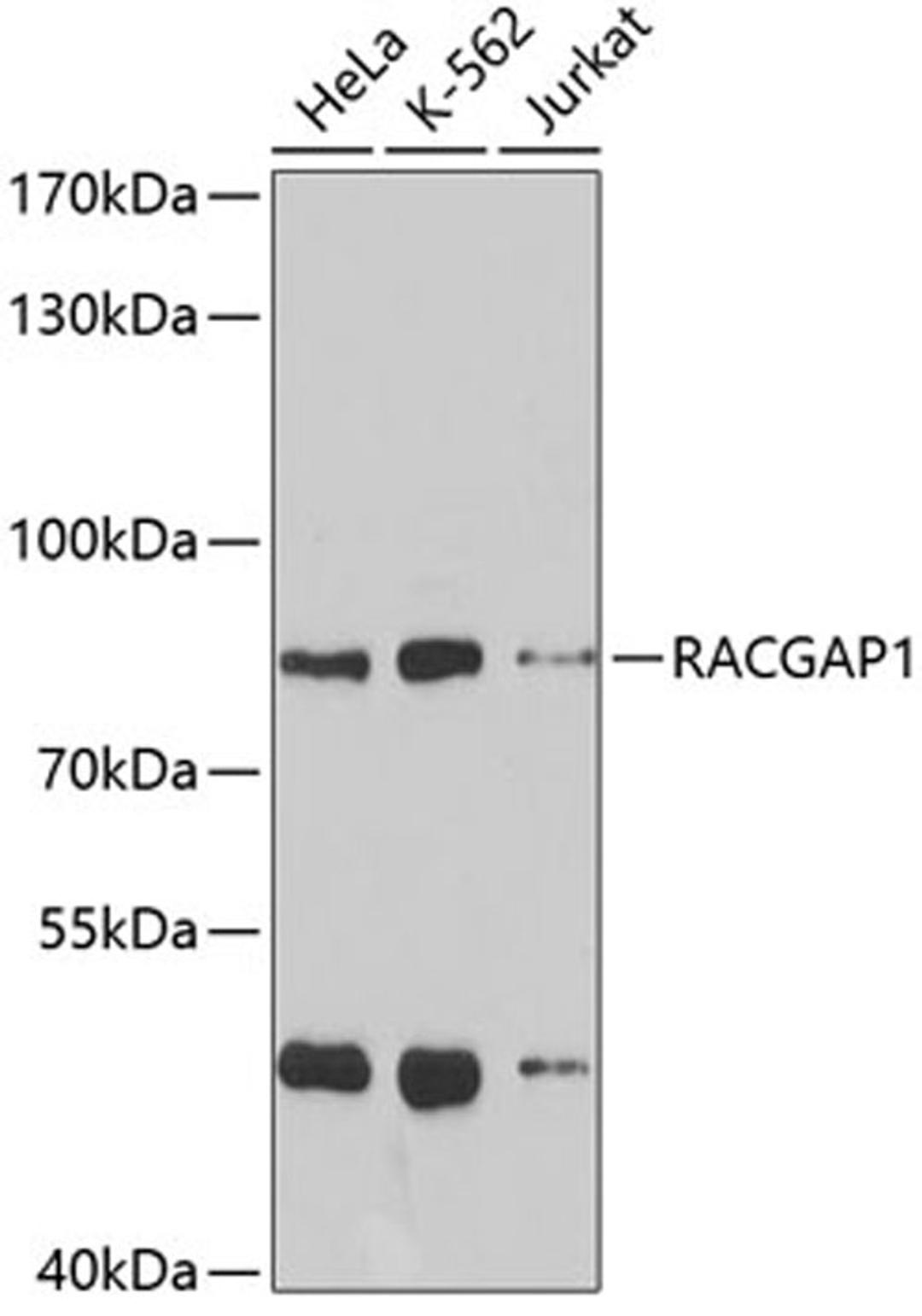 Western blot - RACGAP1 antibody (A5298)