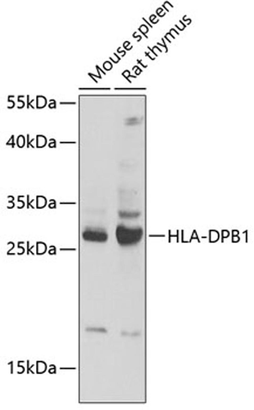 Western blot - HLA-DPB1 antibody (A13997)