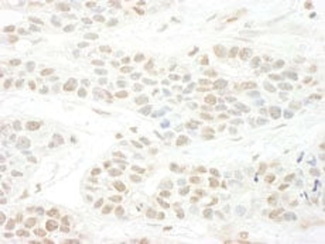 Detection of human BTBD12 by immunohistochemistry.