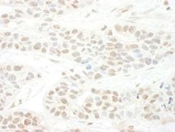 Detection of human BTBD12 by immunohistochemistry.