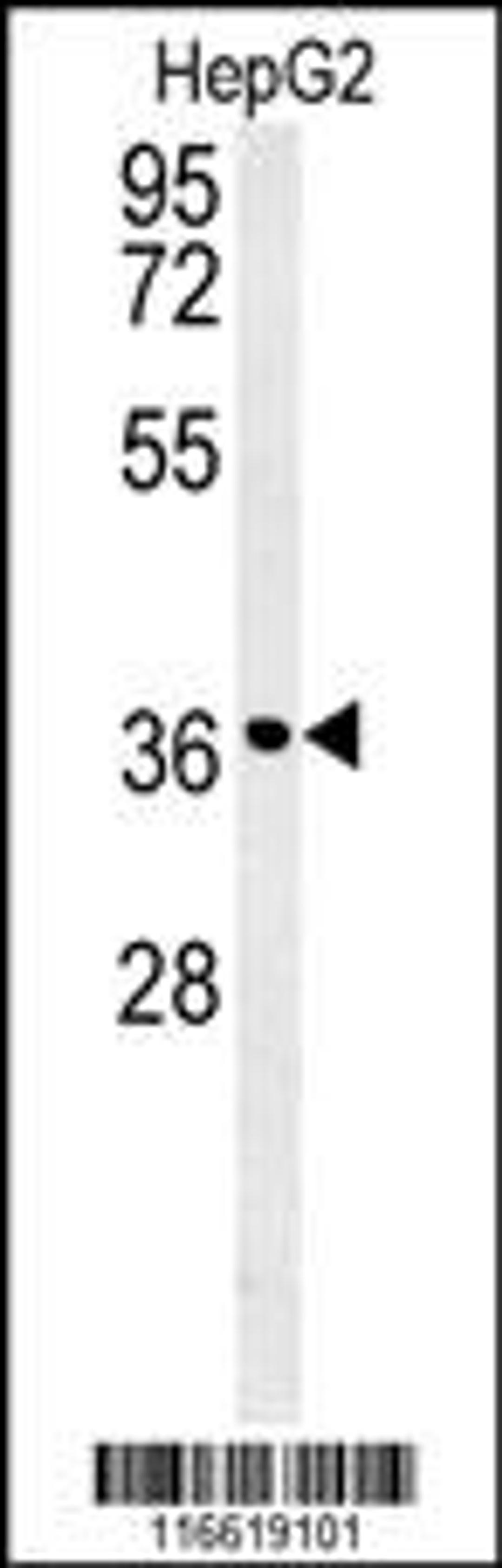 Western blot analysis in HepG2 cell line lysates (35ug/lane).This demonstratesdetected the CCND1 protein (arrow).