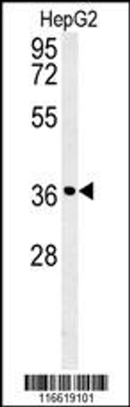 Western blot analysis in HepG2 cell line lysates (35ug/lane).This demonstratesdetected the CCND1 protein (arrow).