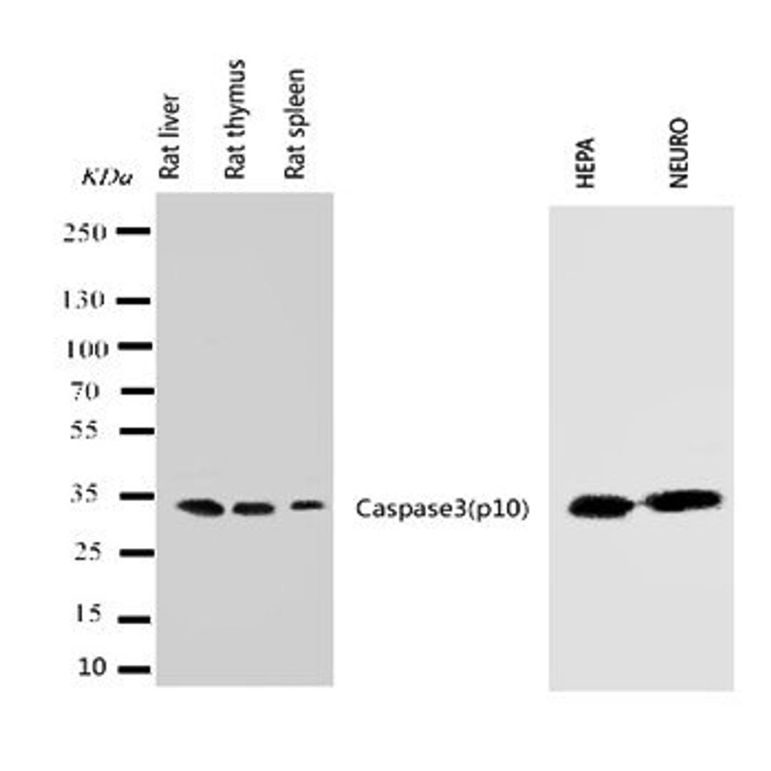 Western blot analysis of Lane 1: Rat Liver Tissue Lysate, Lane 2: Rat Thymus Tissue Lysate, Lane 3: Rat Spleen Tissue Lysate, Lane 4: HEPA Cell Lysate, Lane 5: NEURO Cell Lysate using Caspase-3 (P10) antibody