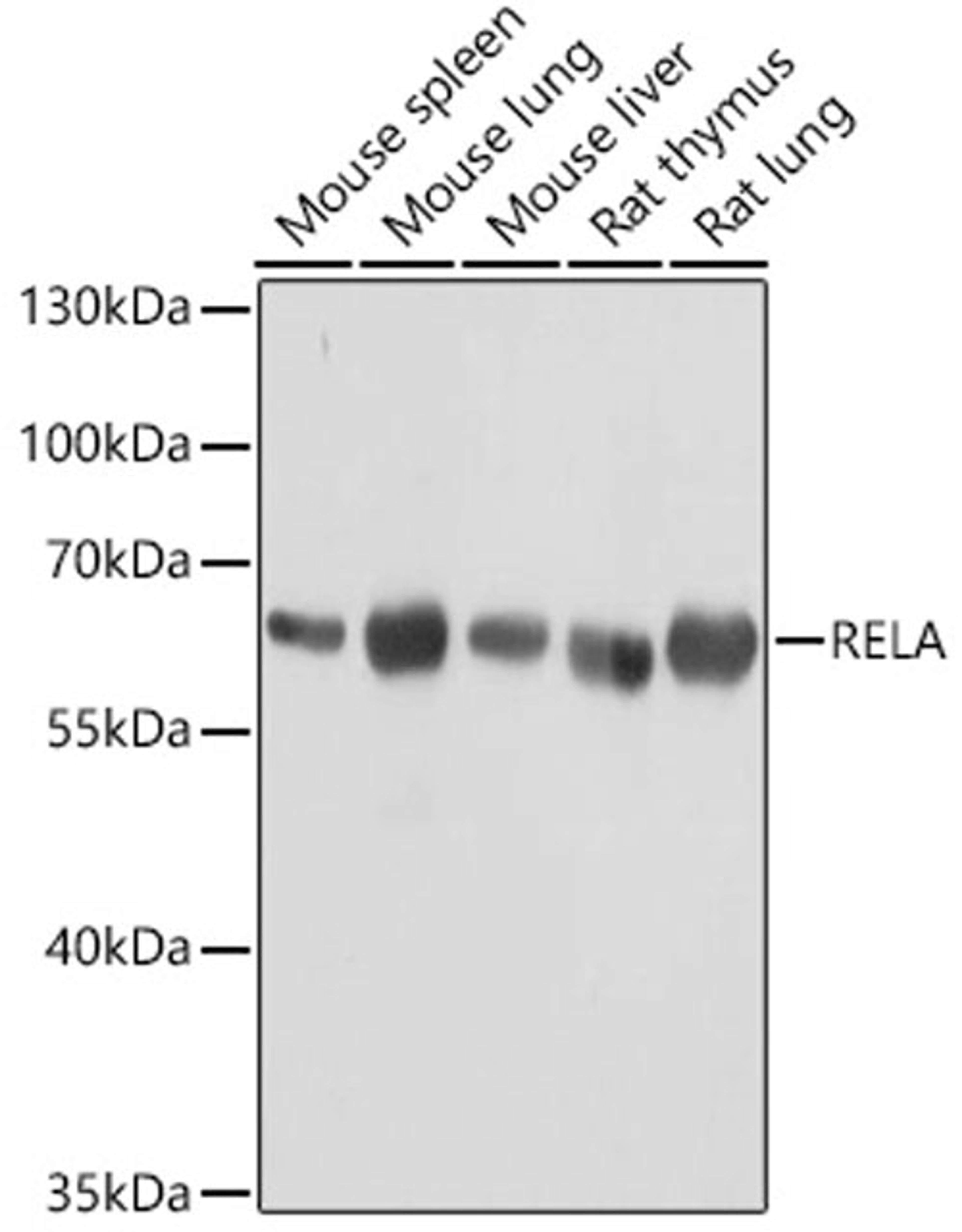 Western blot - RELA antibody (A18210)